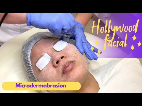Microdermabrasion ▶️ Step 1 of  HOLLYWOOD FACIAL combined therapy. Removes dead  skin cells