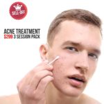 acne treatment package
