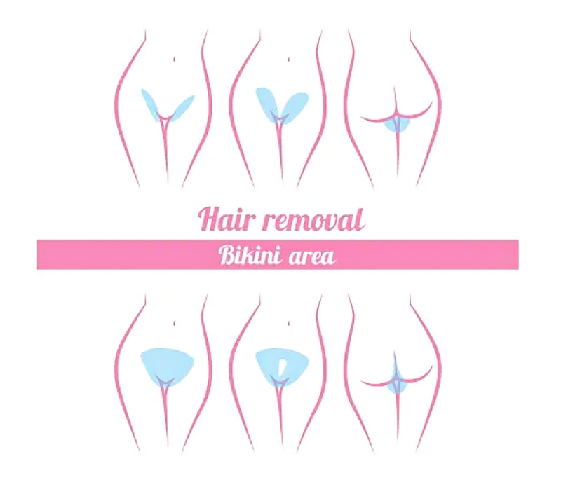 brazilian hair removal for woman