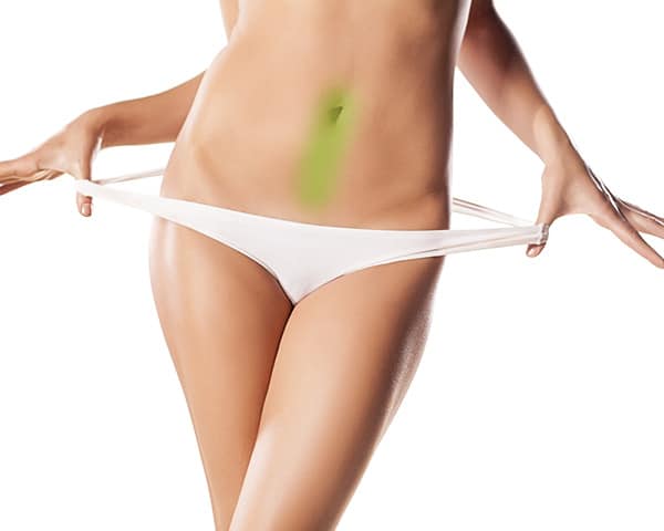 laser hair removal belly button women