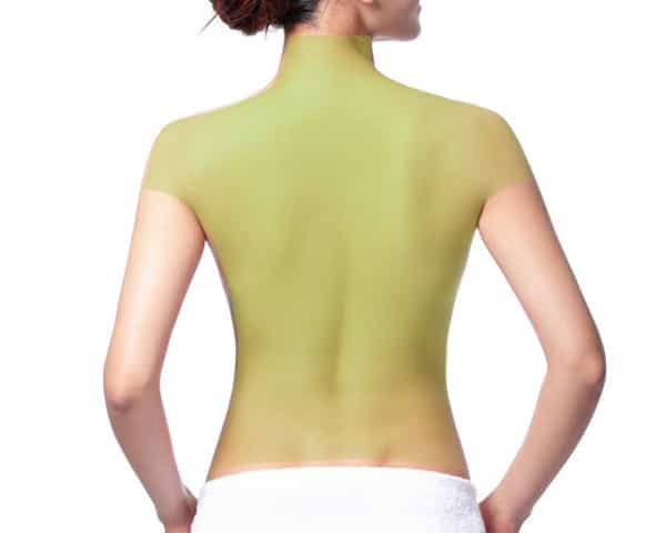 Laser Hair Removal for Women, Full Back, Shoulder and Back of Neck