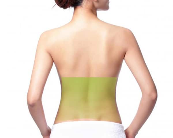 Lower Back Hair Removal for Women | VS MedSpa Laser Clinic