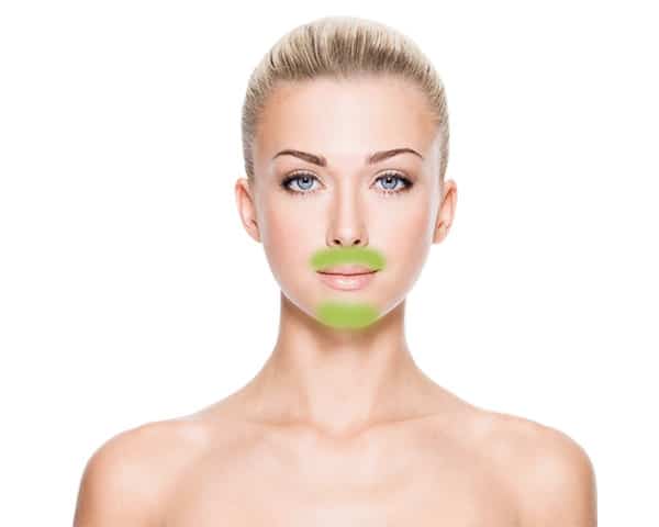 Upper Lip and Chin Laser Hair Removal