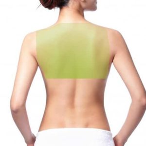 Laser Hair Removal for Women, Upper back