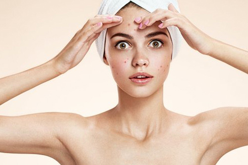 acne treatment and acne scar removal