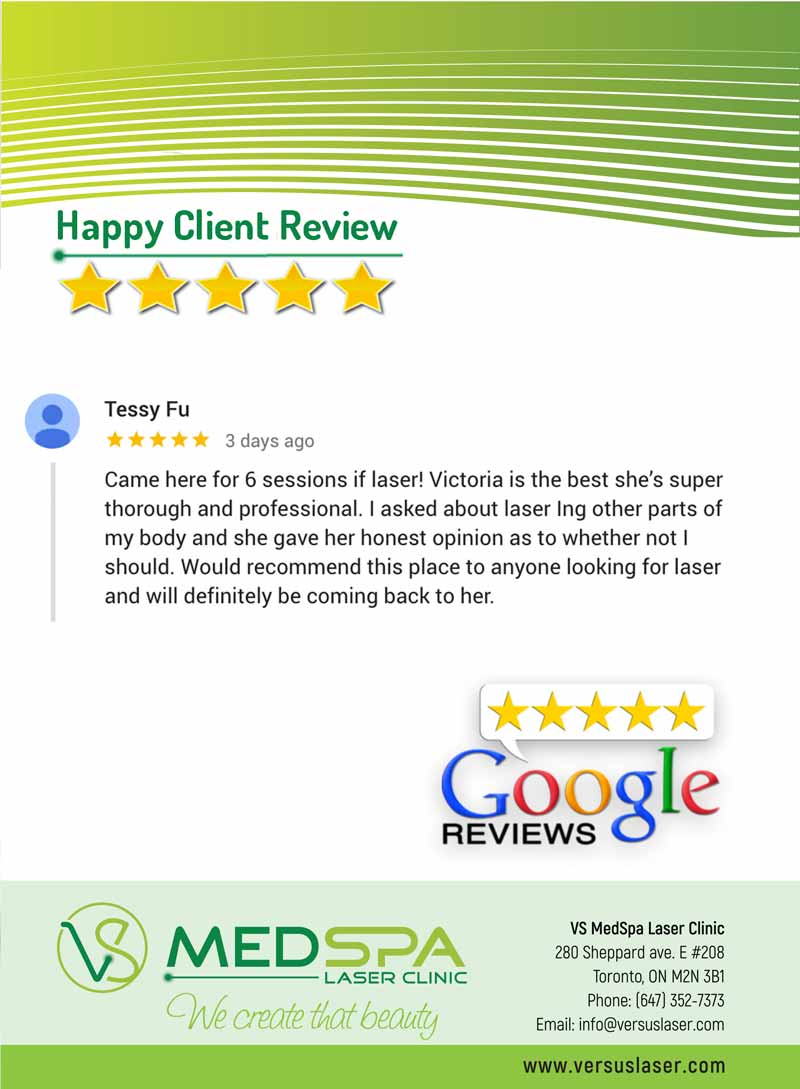 laser hair removal reviews