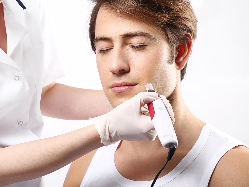 Microneedling for men antiaging facial