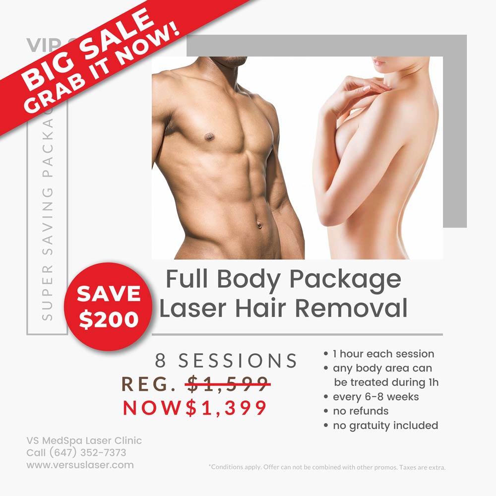 Big Sale Full body laser hair removal pack, 8 sessions