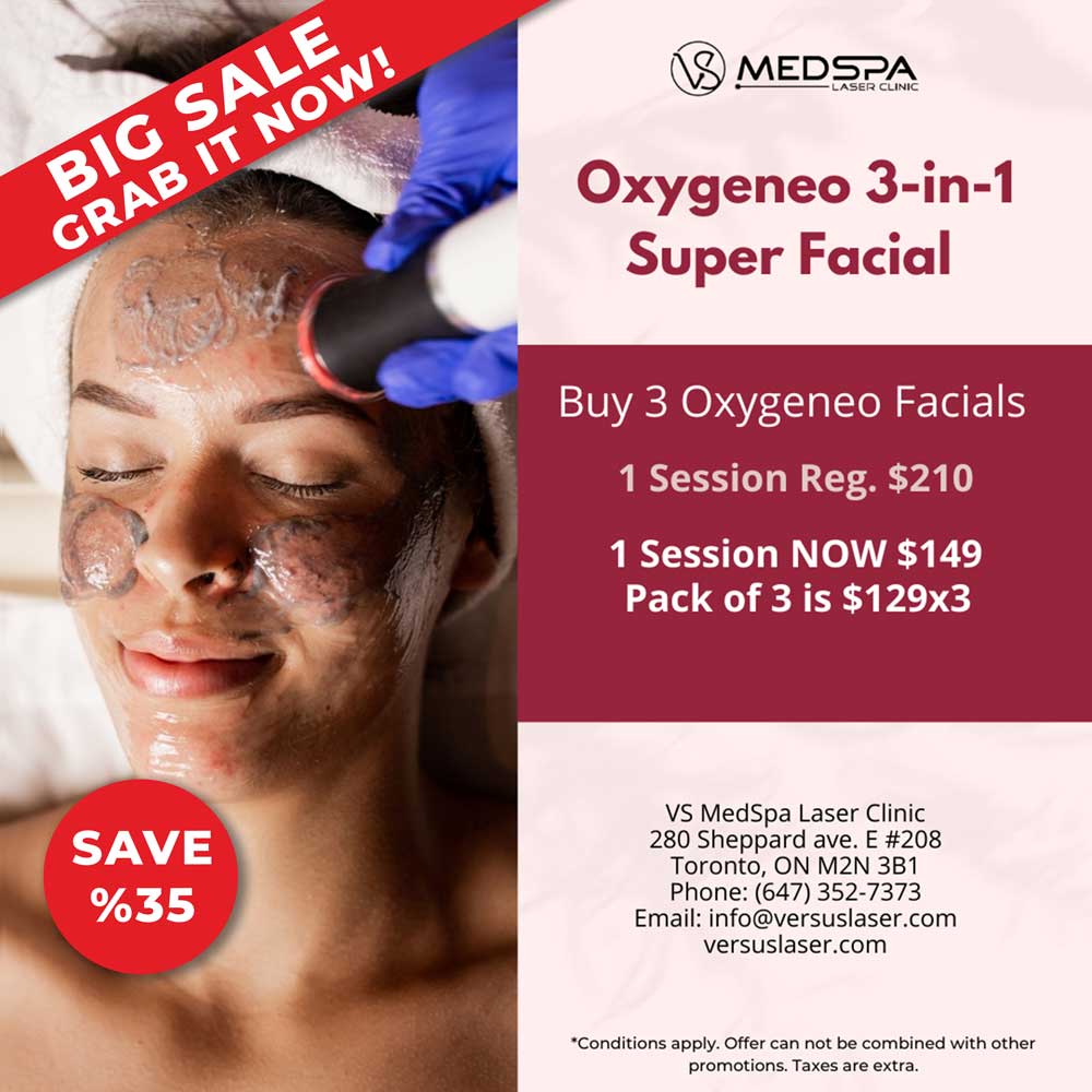 Oxygeneo Facial Sale special