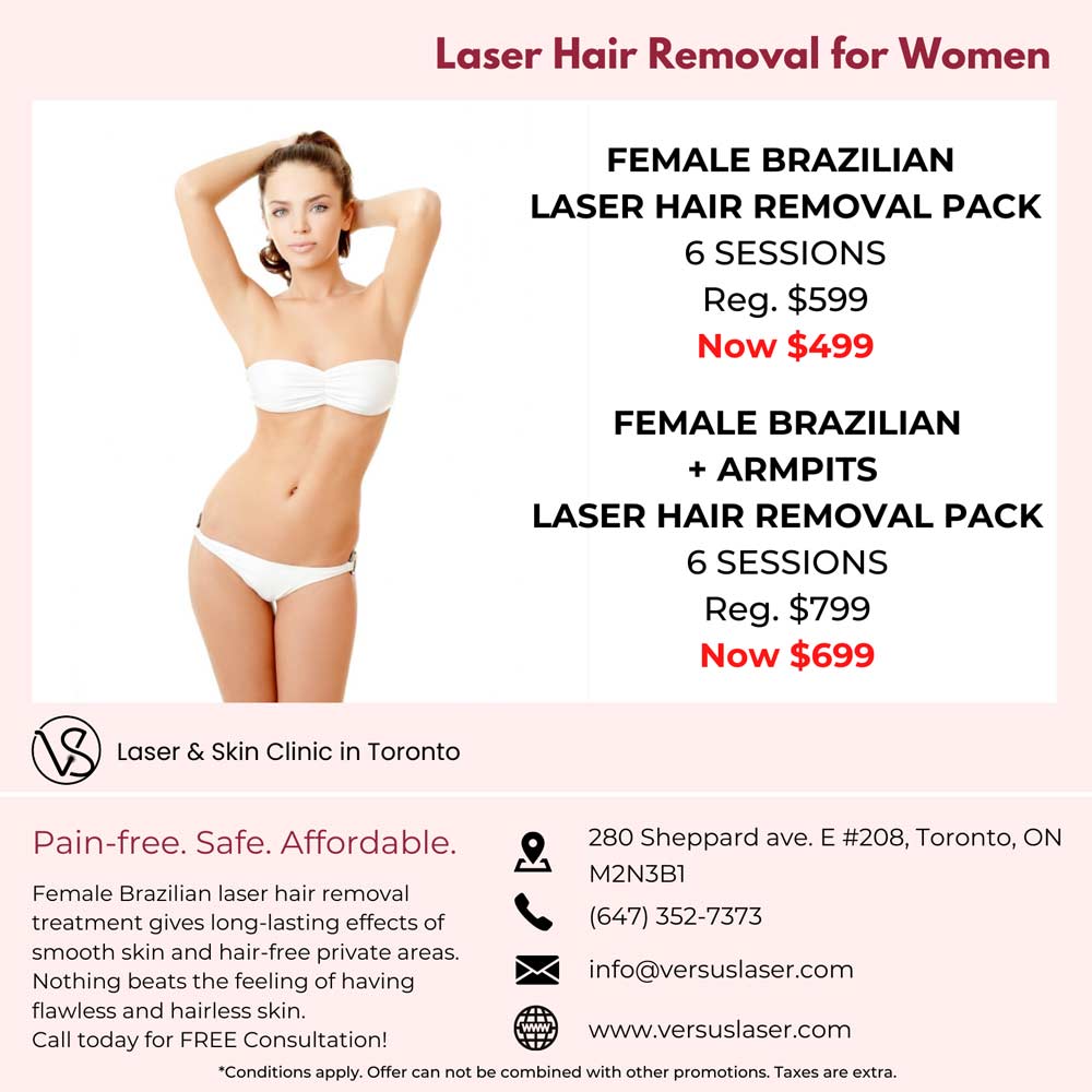 feale brazilian laser hair removal and armpits sale