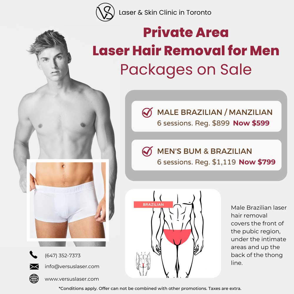 Brazilian laser hair removal private area