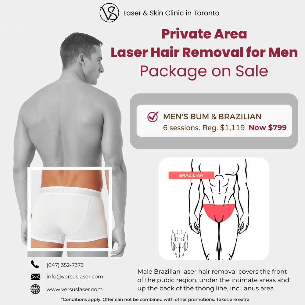 Mens butt and Brazilian laser hair removal