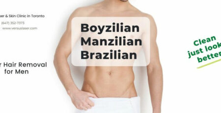 Boyzilian laser hair removal for Men