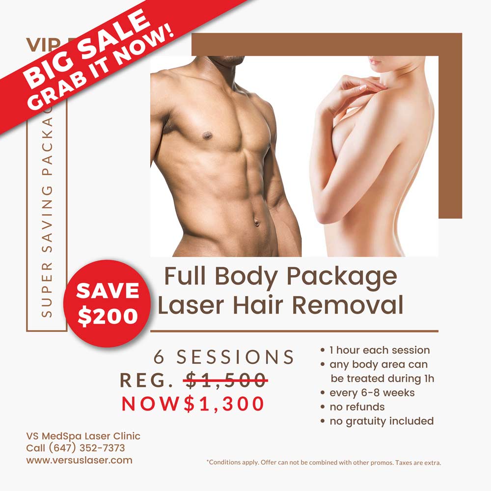 Full Body VIP Bronze Laser Hair Removal Package 6 sessions