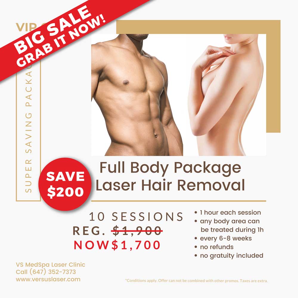 Full Body VIP Gold Laser Hair Removal Package 10 sessions