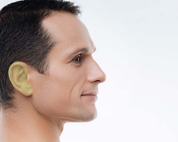 Ears laser hair removal for men