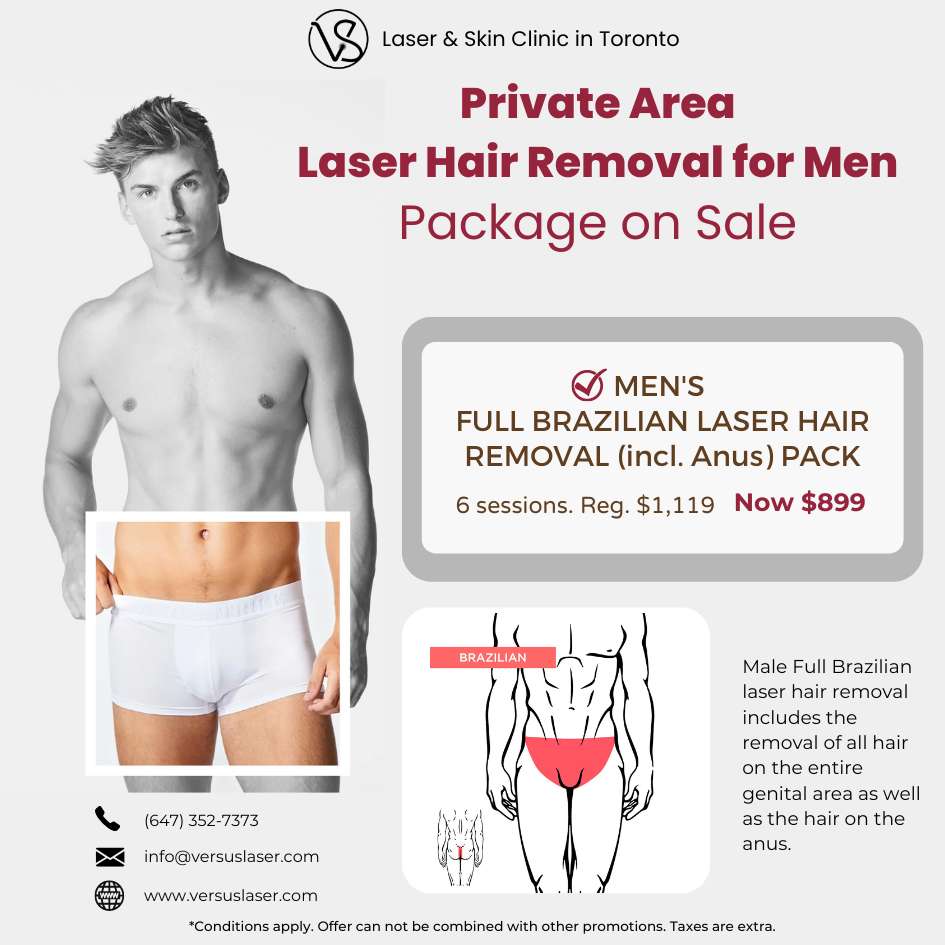 Male Full Brazilian hair removal
