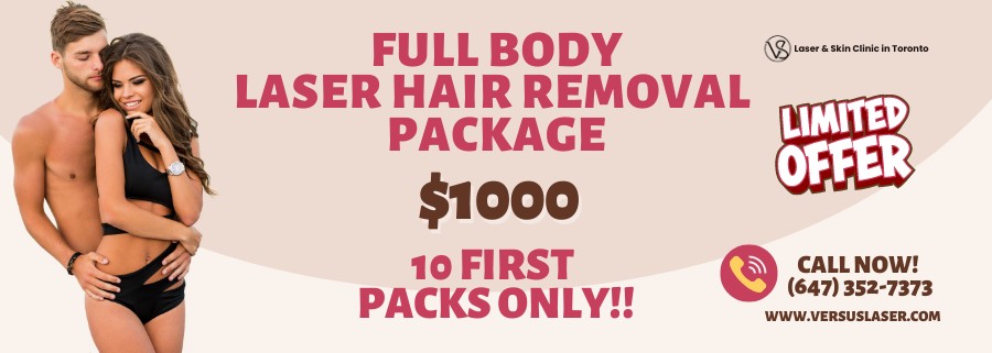 Full Body Laser Hair Removal Package Mother's Day