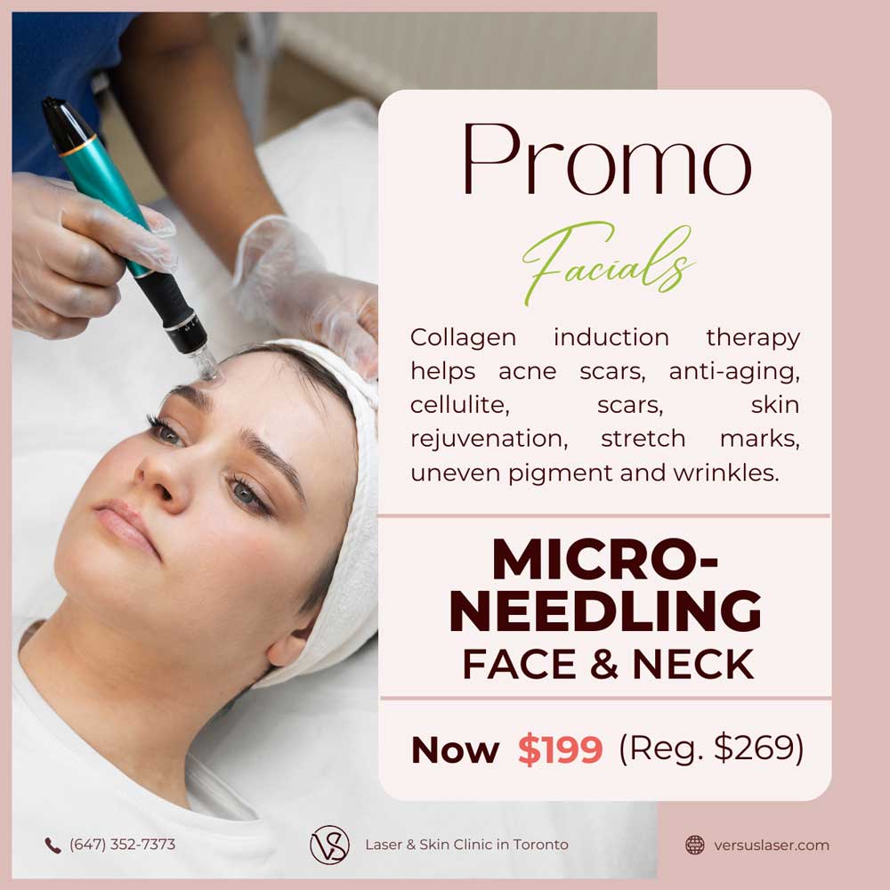 Microneedling face and neck promo Toronto