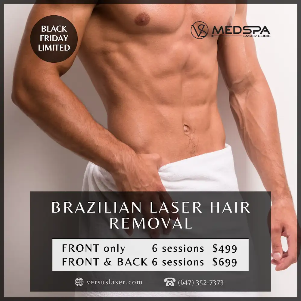 brazilian laser hair removal for men toronto
