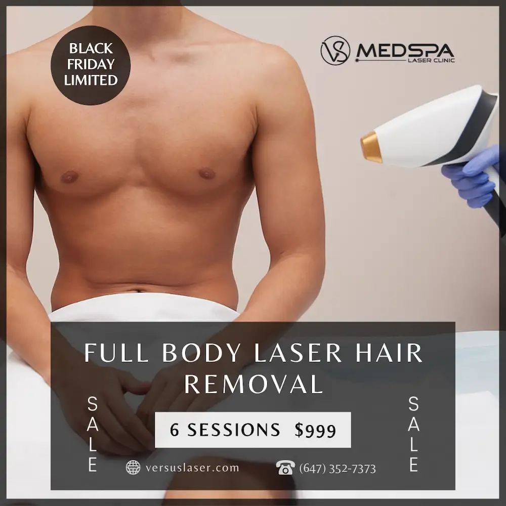 full body laser hair removal for men
