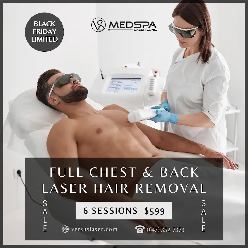 full chest and back laser hair removal for men