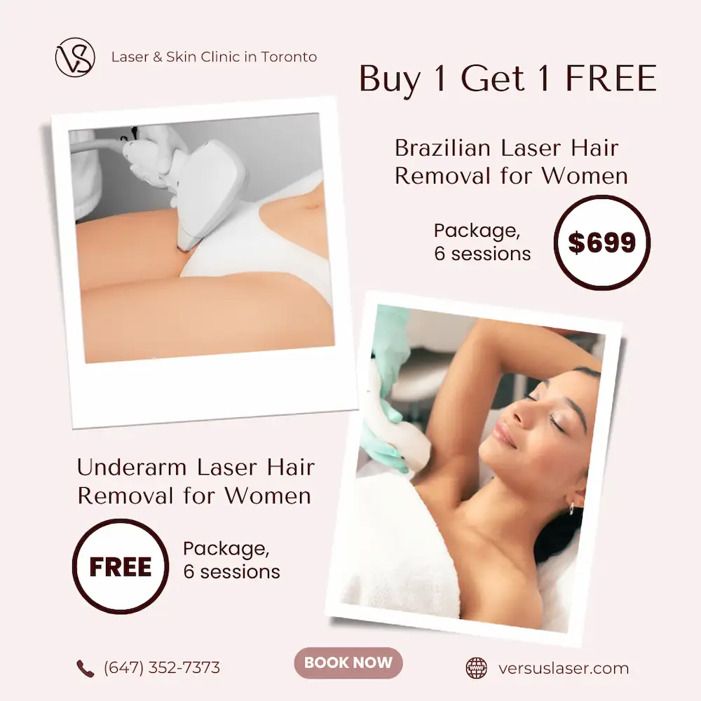 VS MedSpa Brazilian Laser Women Package promo