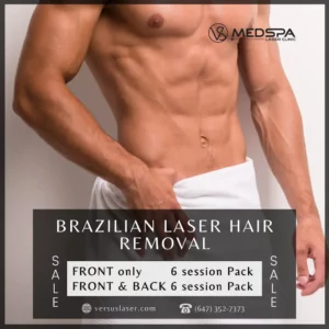 Toronto Brazilian laser hair removal for men