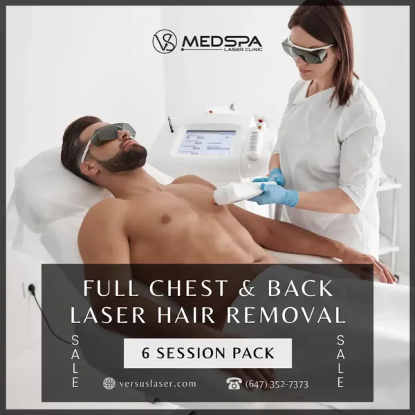 chest and back laser hair removal for men Toronto deal