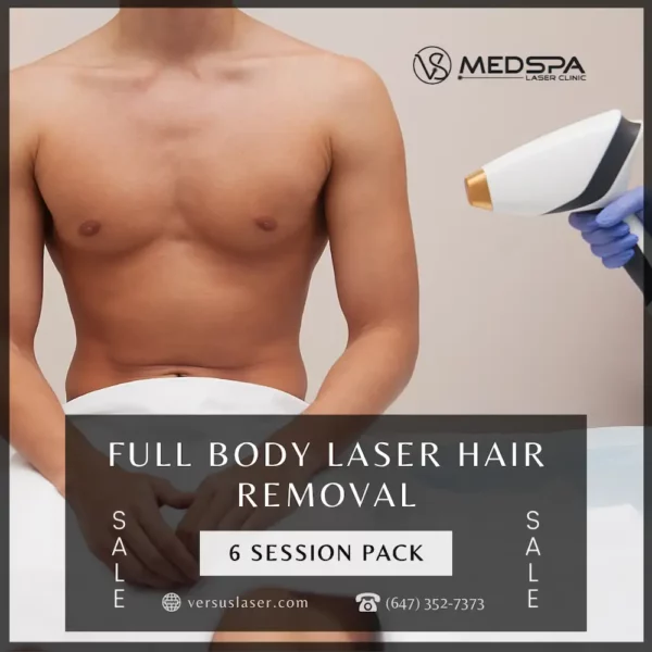 Toronto full body laser hair removal for men