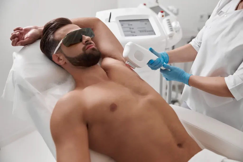 Men laser hair removal North York Toronto